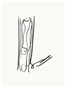 Thomas Libetti, "Arm," silkscreen on paper